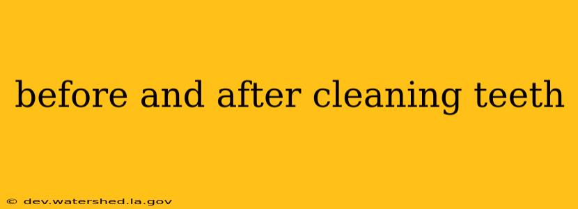 before and after cleaning teeth