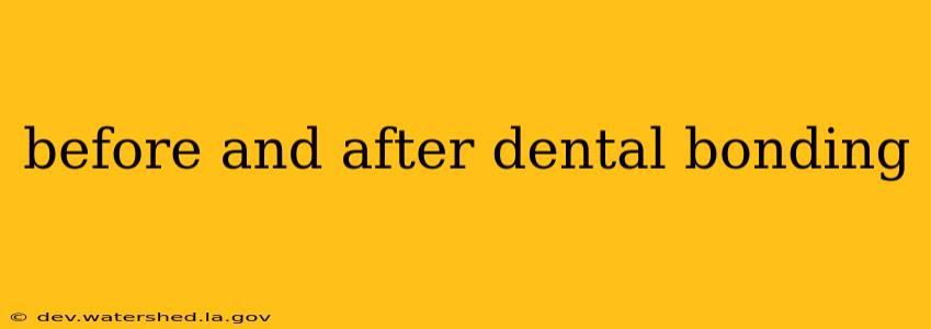 before and after dental bonding