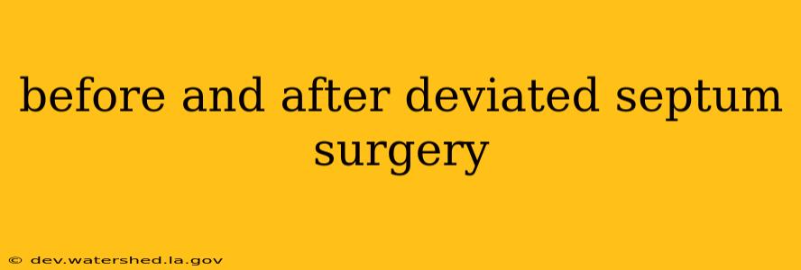 before and after deviated septum surgery