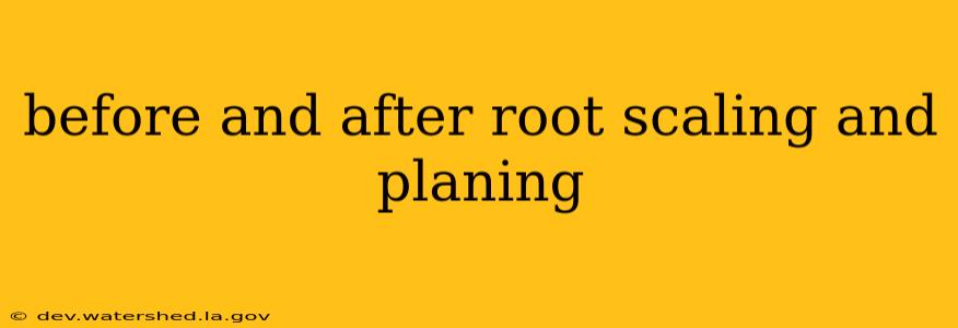 before and after root scaling and planing