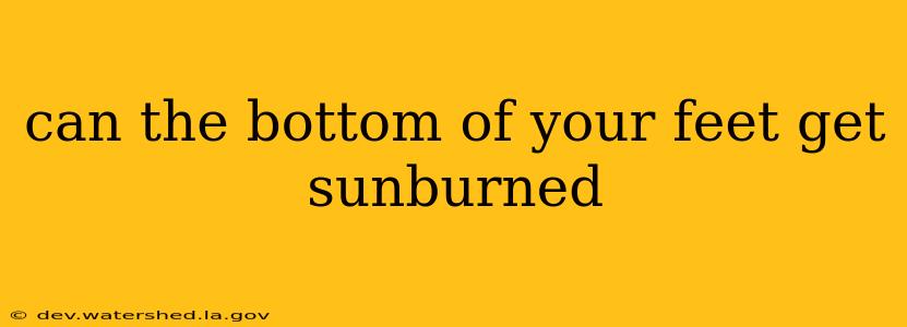 can the bottom of your feet get sunburned
