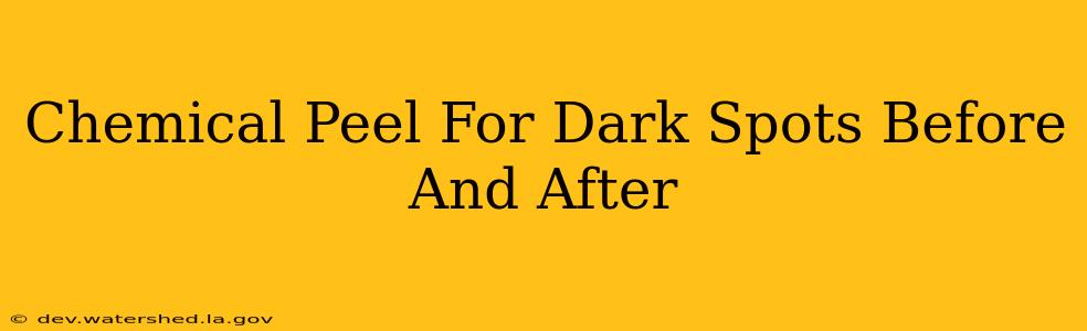 chemical peel for dark spots before and after