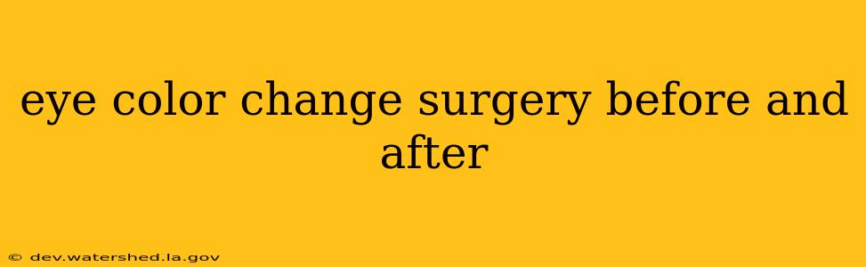eye color change surgery before and after