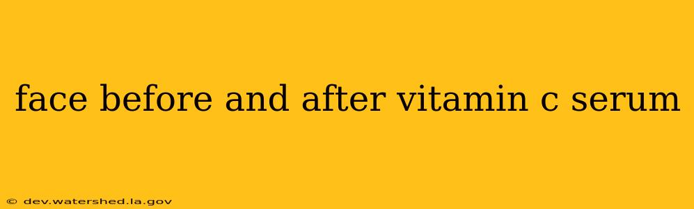 face before and after vitamin c serum