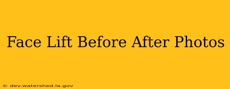 face lift before after photos