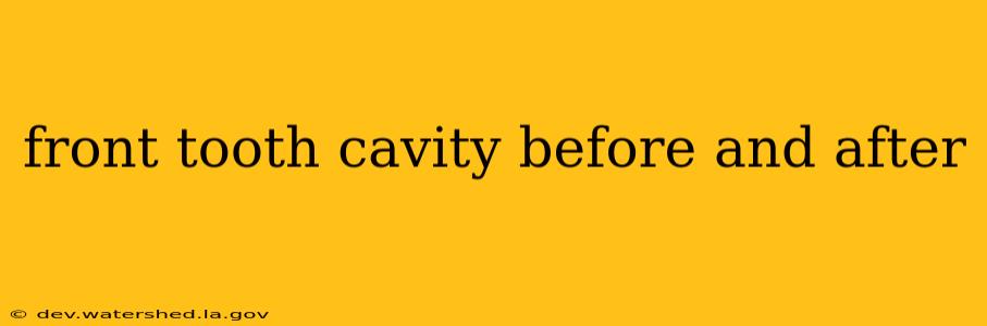 front tooth cavity before and after