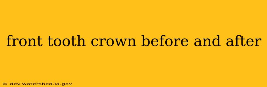 front tooth crown before and after