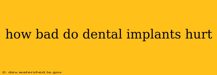 how bad do dental implants hurt