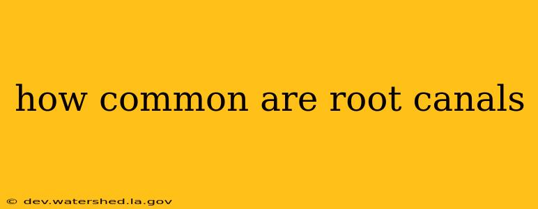 how common are root canals