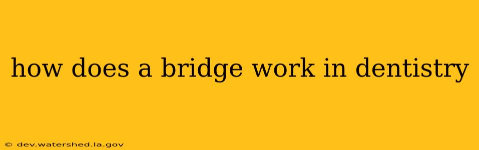 how does a bridge work in dentistry