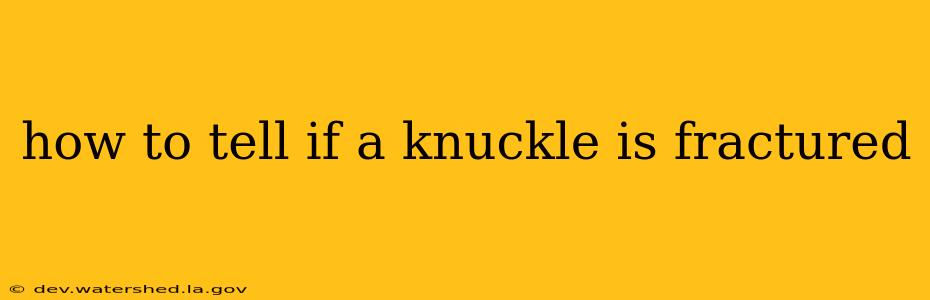 how to tell if a knuckle is fractured
