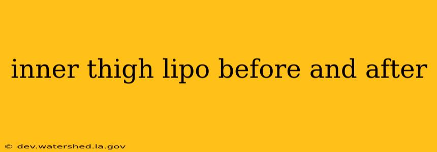 inner thigh lipo before and after