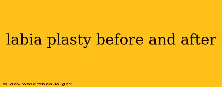 labia plasty before and after