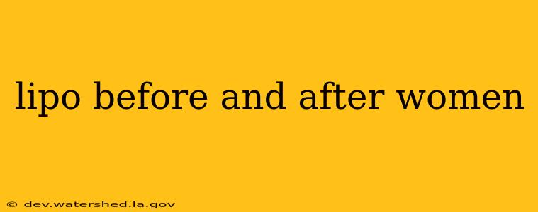 lipo before and after women