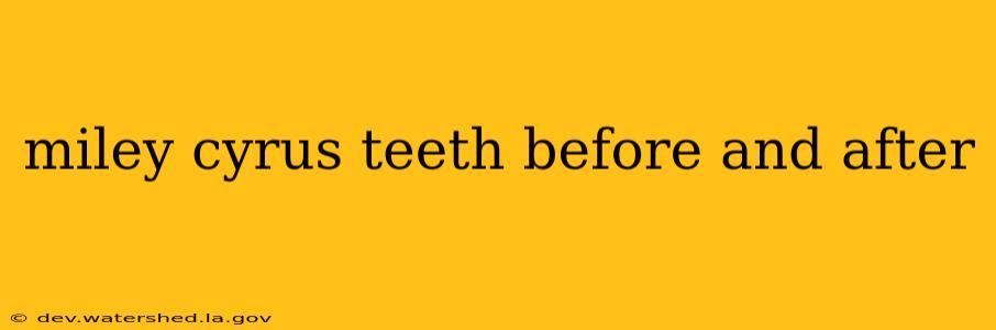 miley cyrus teeth before and after