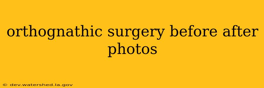 orthognathic surgery before after photos