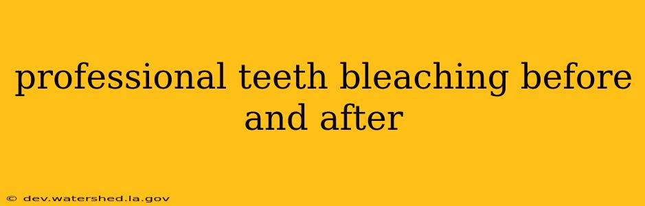 professional teeth bleaching before and after