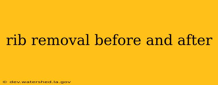 rib removal before and after