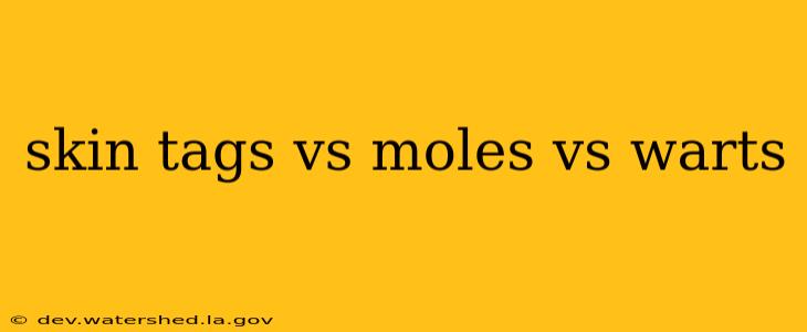 skin tags vs moles vs warts