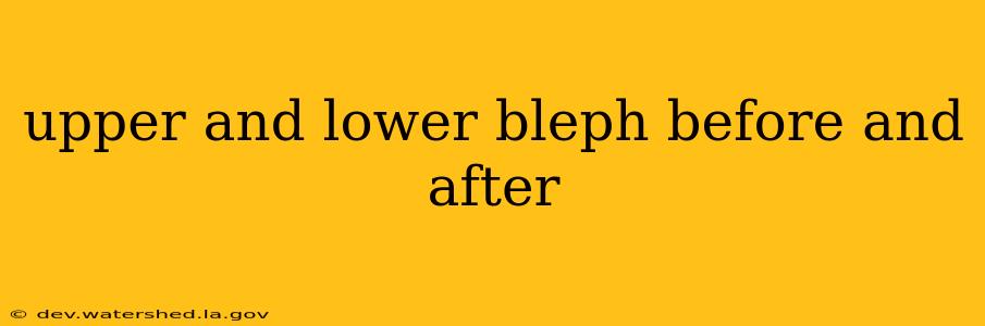 upper and lower bleph before and after