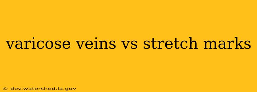varicose veins vs stretch marks