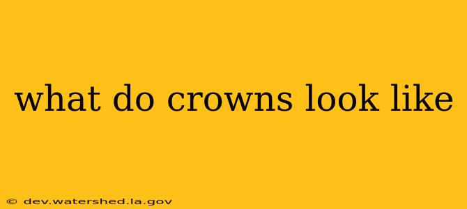 what do crowns look like