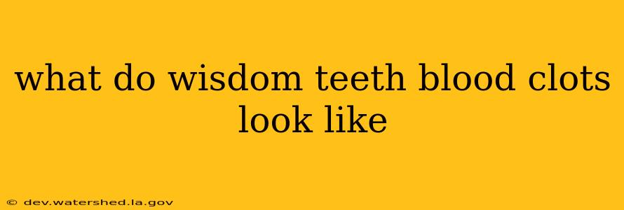 what do wisdom teeth blood clots look like