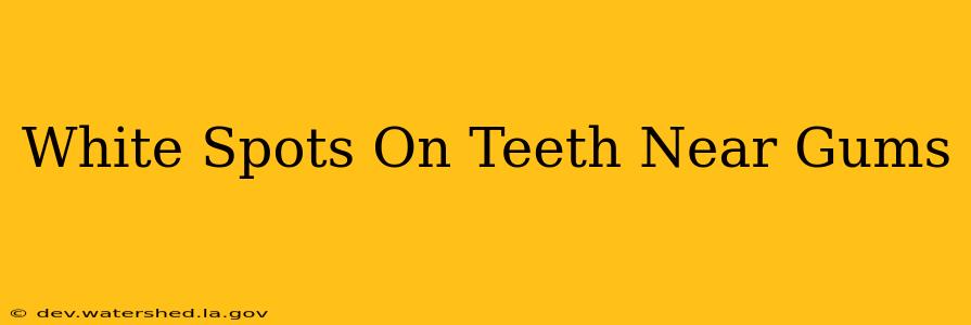 white spots on teeth near gums