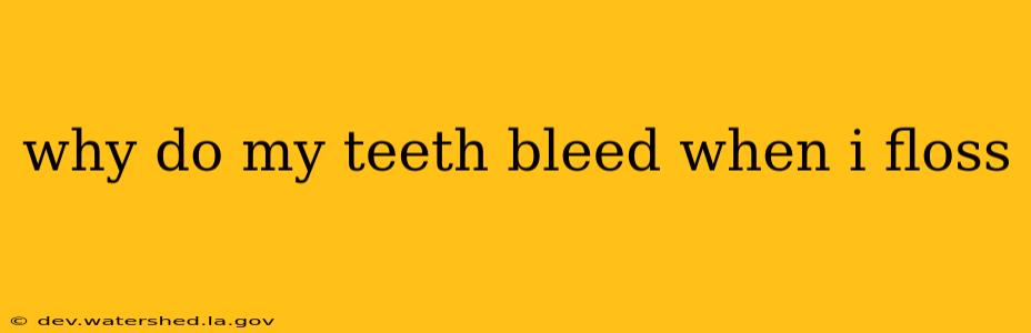 why do my teeth bleed when i floss