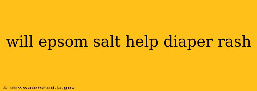 will epsom salt help diaper rash