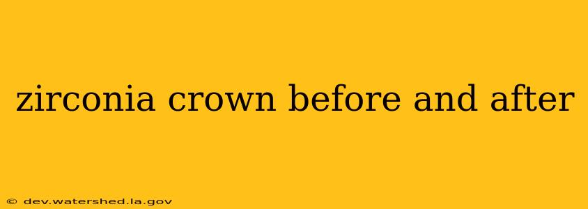 zirconia crown before and after